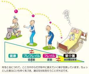フレイルがすすむと